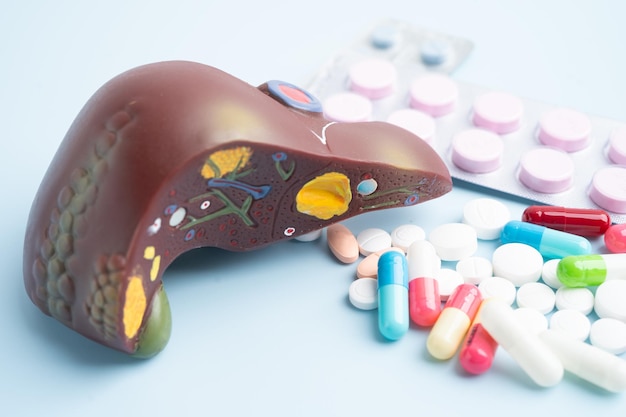 Jakie witaminy przy marskości wątroby warto uwzględnić w diecie?